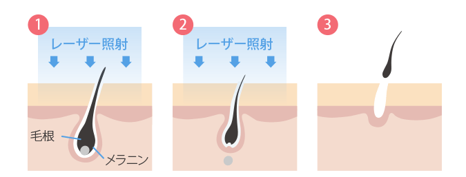 渋谷美容外科クリニック