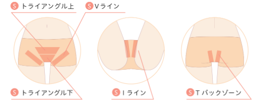 ジェイエステ_vio範囲