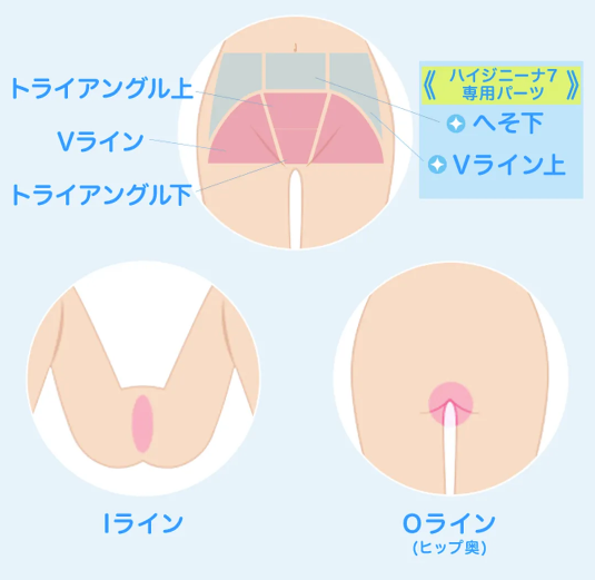 ミュゼのvio脱毛範囲
