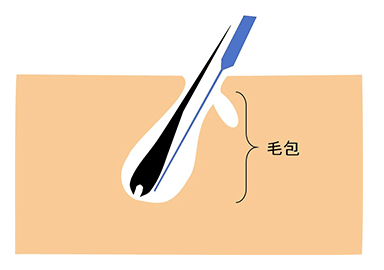 施術イラスト
