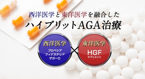 AGA治療