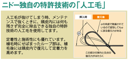 NDクリニックの人工毛