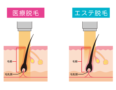 医療とサロンの違い