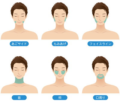 顔脱毛箇所