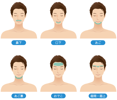 顔脱毛箇所