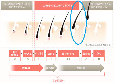 tbcスーパー_脱毛時期