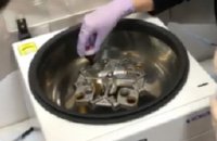 tomクリニック_prp療法