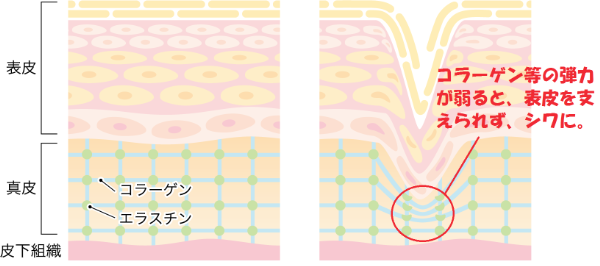 シワの原因_イラスト
