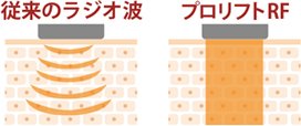 シーズラボ_面照射