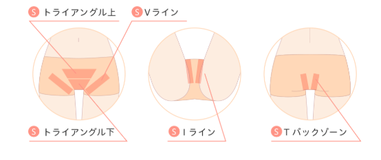 ジェイエステ_vio