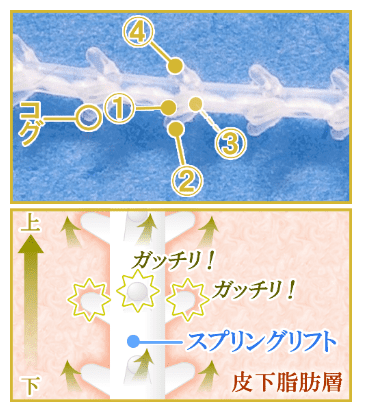 スプリングリフト