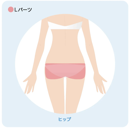 ミュゼ_ヒップ