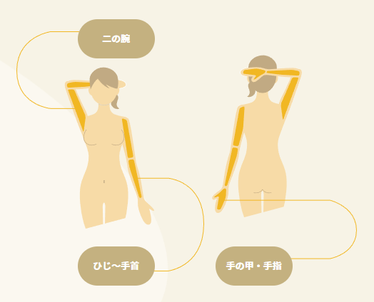 リゼ腕全体セット