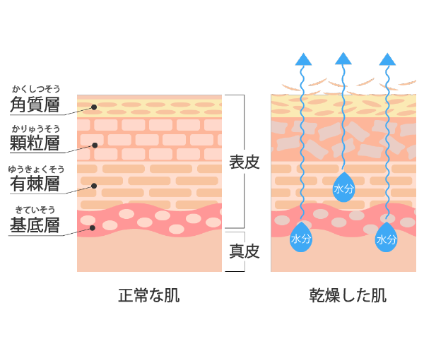 乾燥肌_イラスト