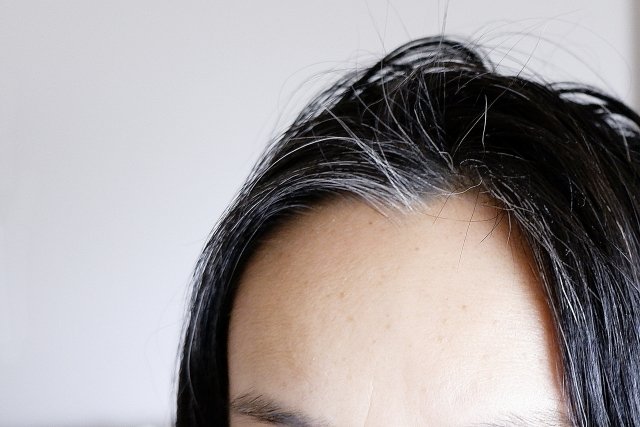 女性の生え際白髪