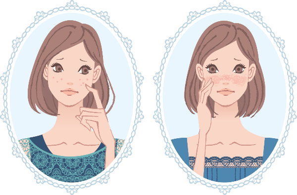 敏感乾燥肌_イラスト