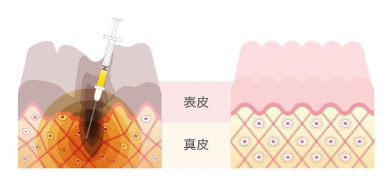 秋葉原中央_PRPイメージ