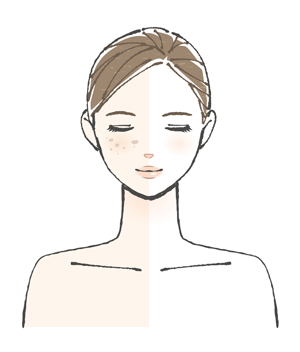 シミ有無